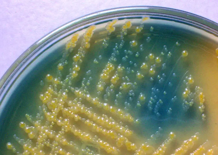 CLED Agar: Composition, Uses, Colony Characteristics • Microbe Online