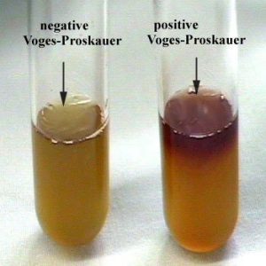 Results of Voges-Proskauer (VP) Test