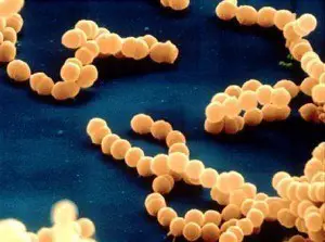 Streptococcus as seen in Scanning electron microscope 