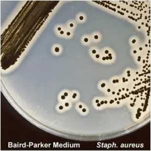 Colonies of Staphylococcus aureus in Baird Parker Agar Medium