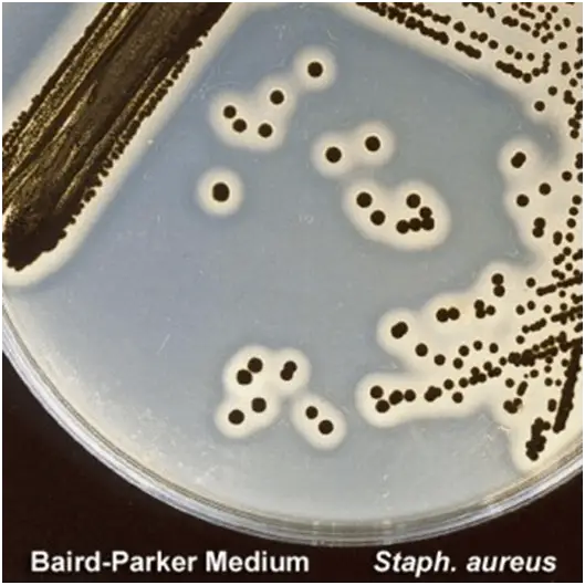 Baird-Parker Agar: Preparation, Composition, and Uses