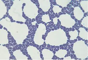 Staphylococcus in Gram Stain