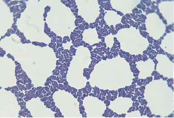 Staphylococcus aureus: Disease, Properties, Lab Diagnosis