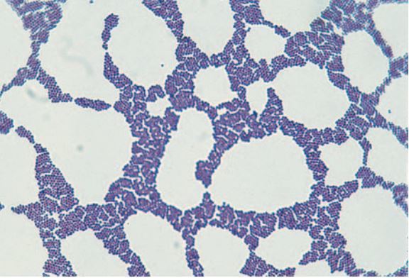 Staphylococcus aureus, Gram-stained S. aureus viewed under …