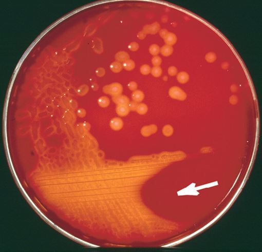 Study of Genes Found in Streptococcus Agalctiae