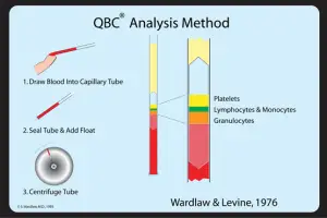 QBC analysis Method