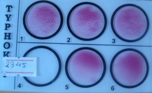 Widal Test: Quantitative test for H antibody (Serial double dilution order from 1-2-3-6-5)