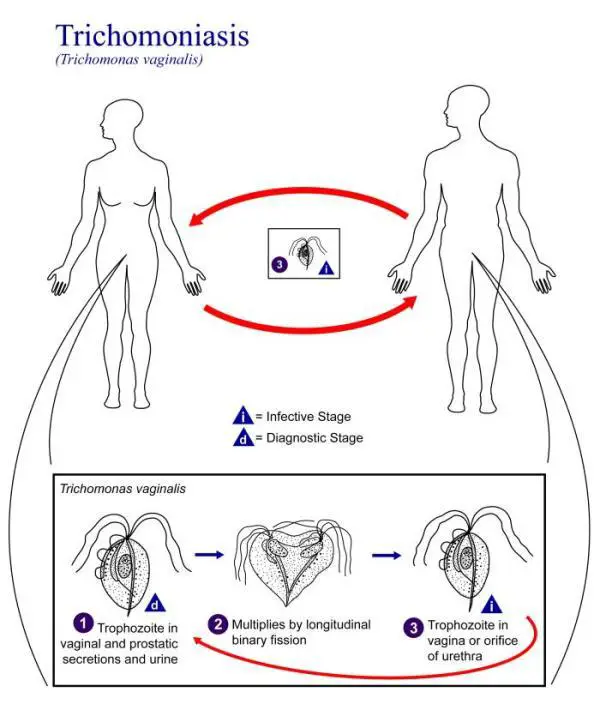 Lab Diagnosis of Trichomonas vaginalis infections