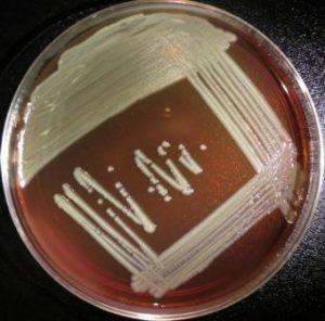 Photo 1: Elizabethkingia anophelis growing on a blood agar plate. Photo courtesy of the CDC and Prevention Special Bacteriology Reference Lab.