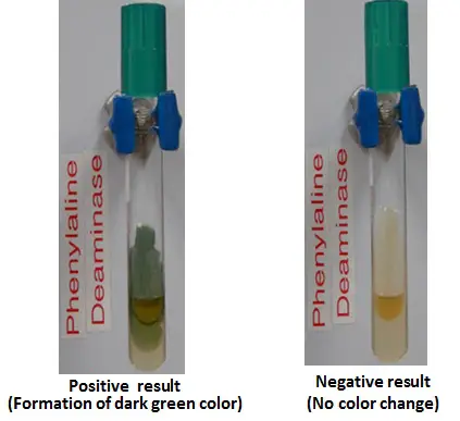 Phenylalanine Deaminase Test: Principle, Procedure, Results