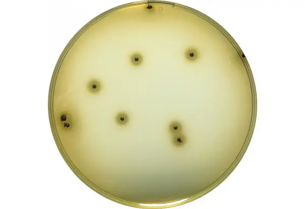 Bismuth Sulfite Agar: Composition, Uses, Colony Morphology
