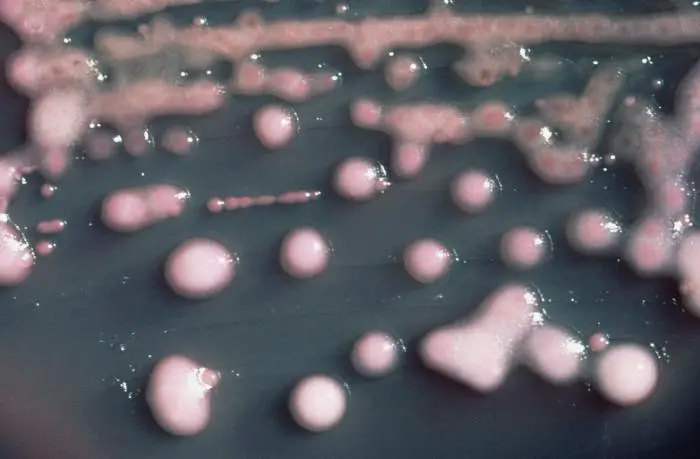 Mucoid colonies of Klebsiella pneumoniae