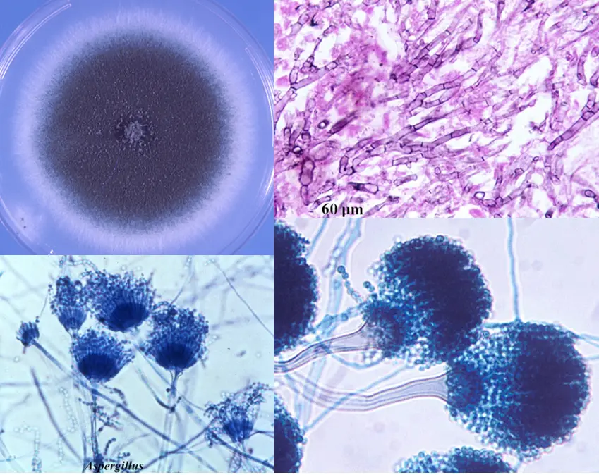Aspergillus fumigatus: Morphology, Pathogenesis, Lab Diagnosis