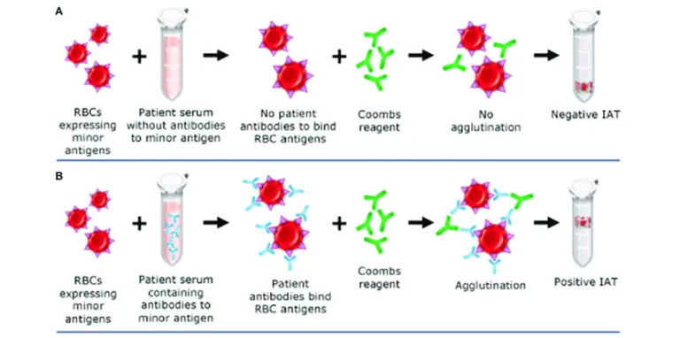 Coombs Test Types Principle Procedure Results Microbe Online