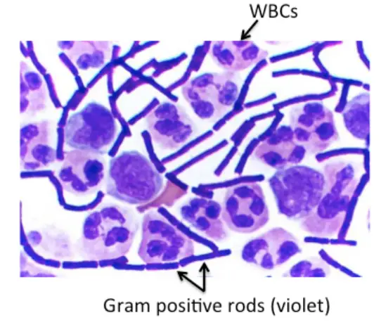 Gram-Positive Bacilli (Rods) and Diseases