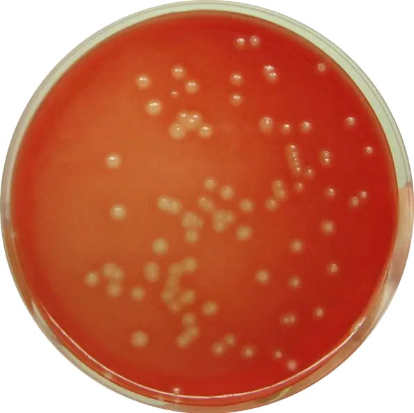 Beta-hemolytic colonies of Streptococcus agalactiae