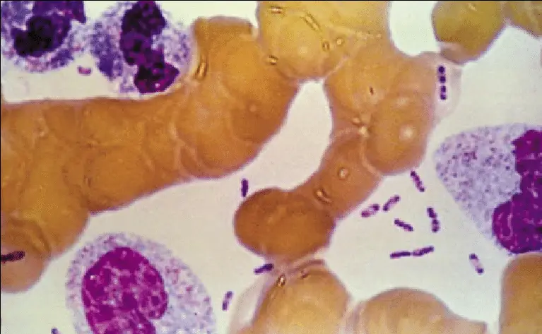 Bipolar appearance of Yersinia pestis in Giemsa stain