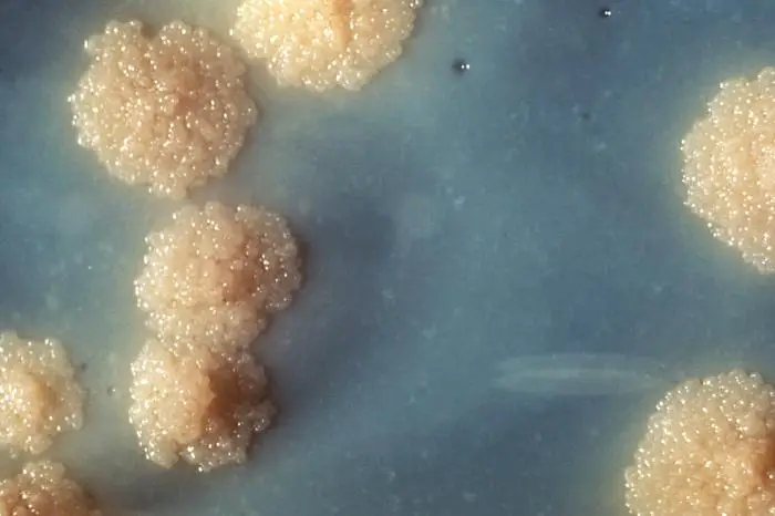 Close view of Mycobacterium tuberculosis colonies 