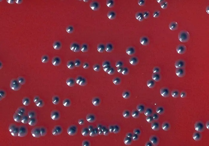 Colonies of Corynebacterium diphtheriae biotype gravis in tellurite blood agar