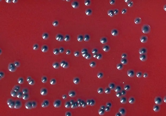 Corynebacterium Diphtheriae Pathogenesis Lab Diagnosis