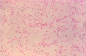 Legionella pneumophila: Properties, Pathogenesis, Lab Diagnosis ...