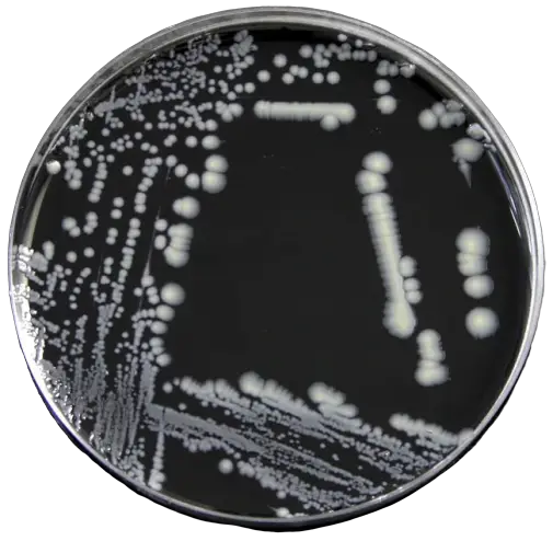 Legionella pneumophila colonies in BCYE agar
