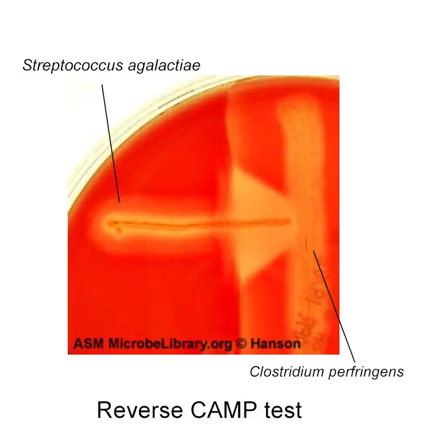 Reverese CAMP test