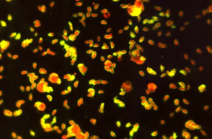 Fluorescent antibody-stained specimen showing numerous, Toxoplasma sp. tachyzoite