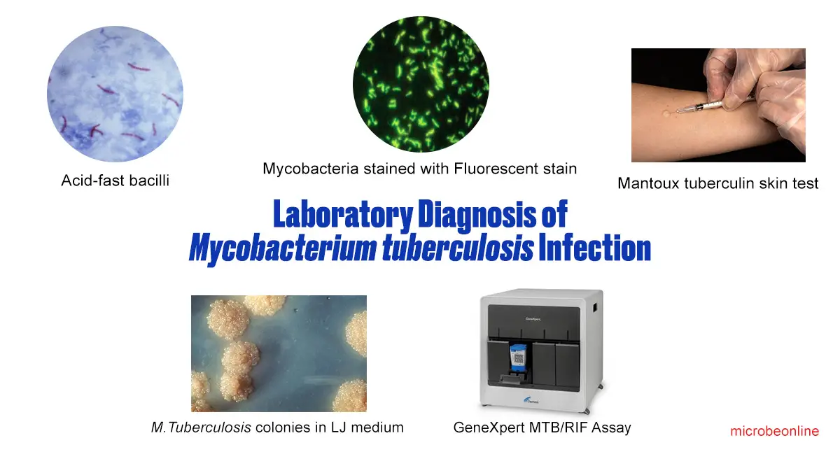 Housekeeping Genes Tuberculosis at Jonathan Locke blog