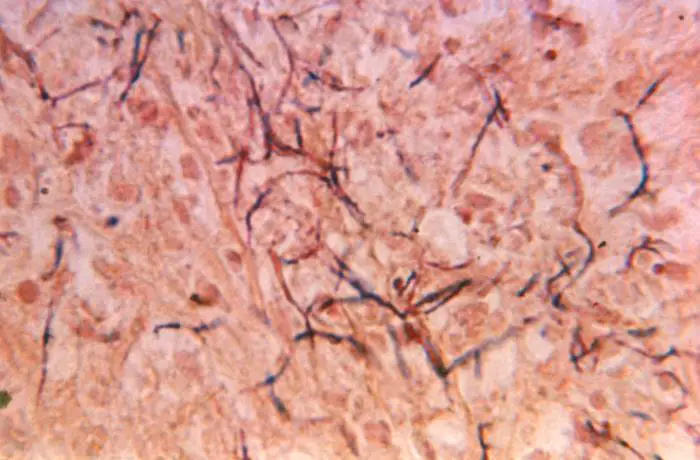 Nocardia spp in tissue section stained using the Brown & Brenn method