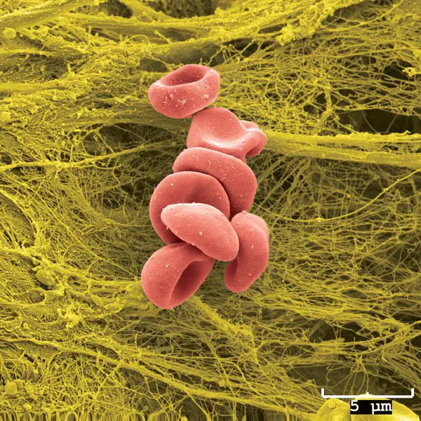RBC seen in Scanning Electron Microscope