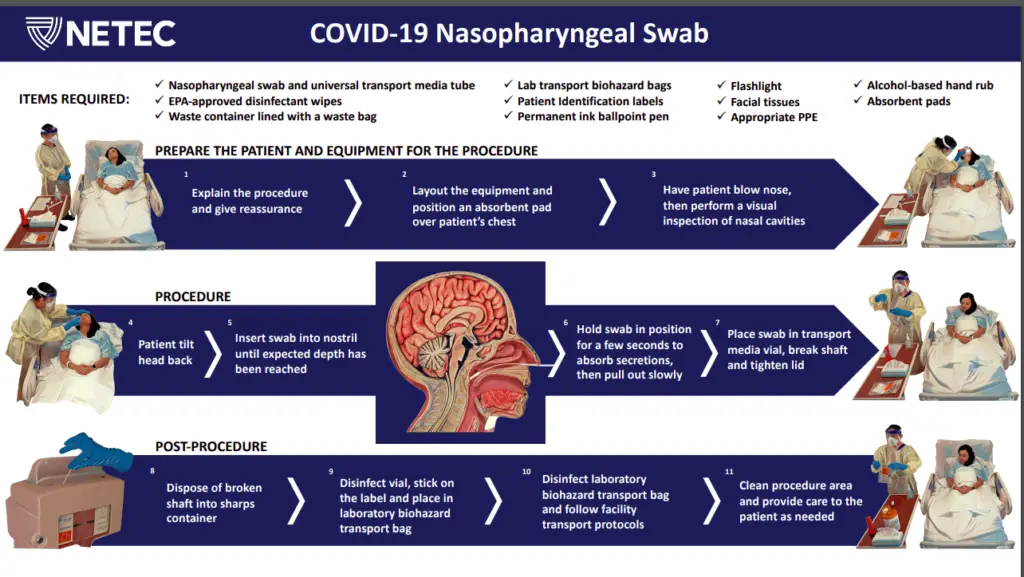 COVID-19 Nasopharyngeal swab collection procedure