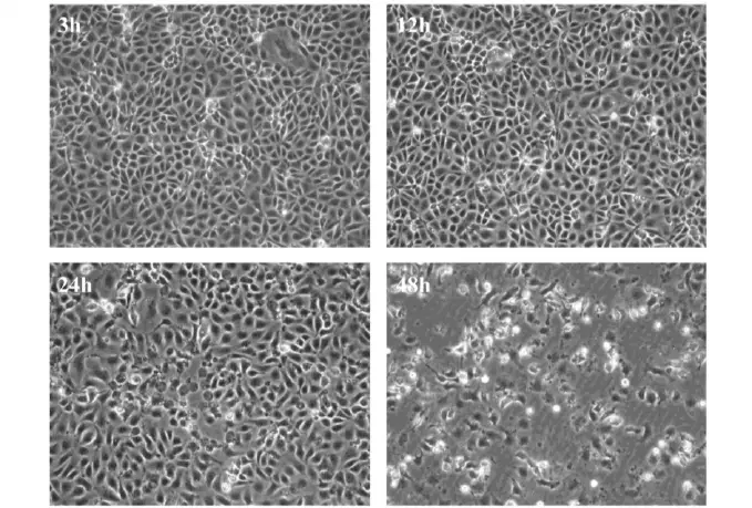 Cytopathic effect (CPE) of Viruses: Types with Examples – Microbe Online