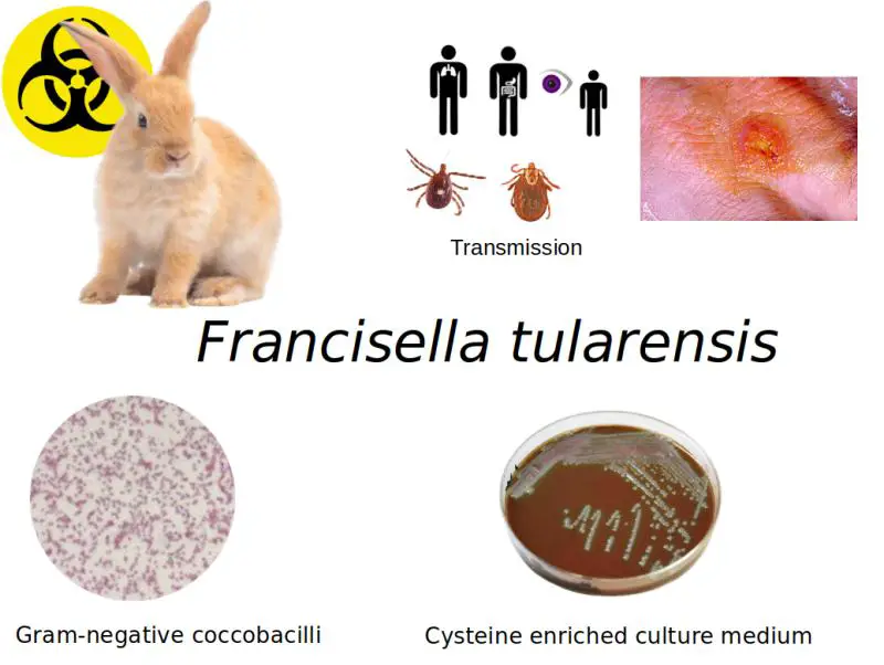 Francisella tularensis: Properties, Pathogenesis, Lab Diagnosis