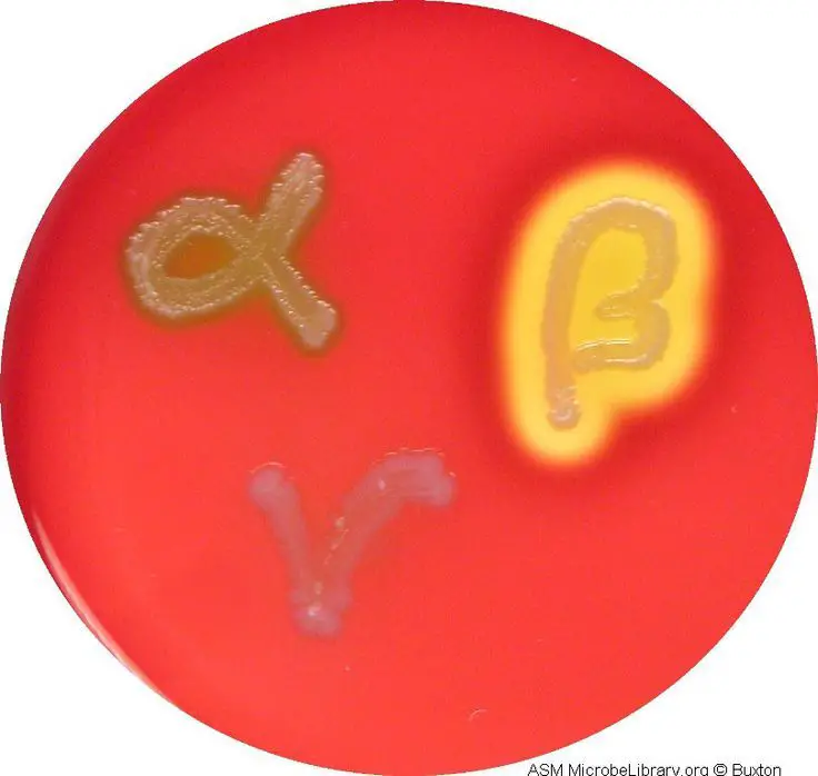 Types Of Hemolysis On Blood Agar at Melvin Johnson blog