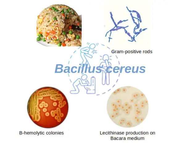 Bacillus cereus: Morphology, Disease, Biochemical Tests