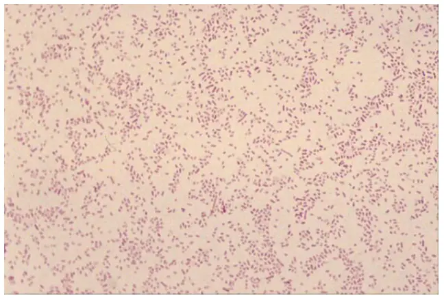 Brucella appearing as faintly staining ram-negative coccobacilli 