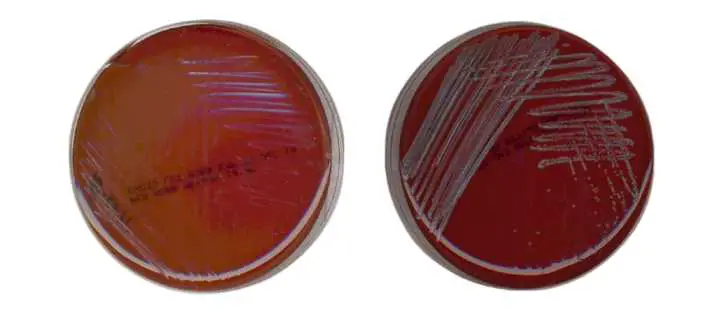 Phenylethyl Alcohol Agar: Composition, Preparation, Uses