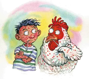chicken pox cartoon