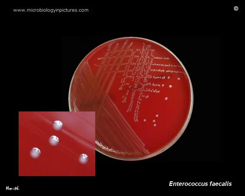 Enterococcus faecalis: Properties, Pathogenesis, Lab Diagnosis