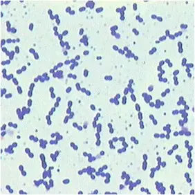 Enterococcus in gram-stain