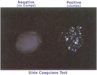 Slide coagulase test