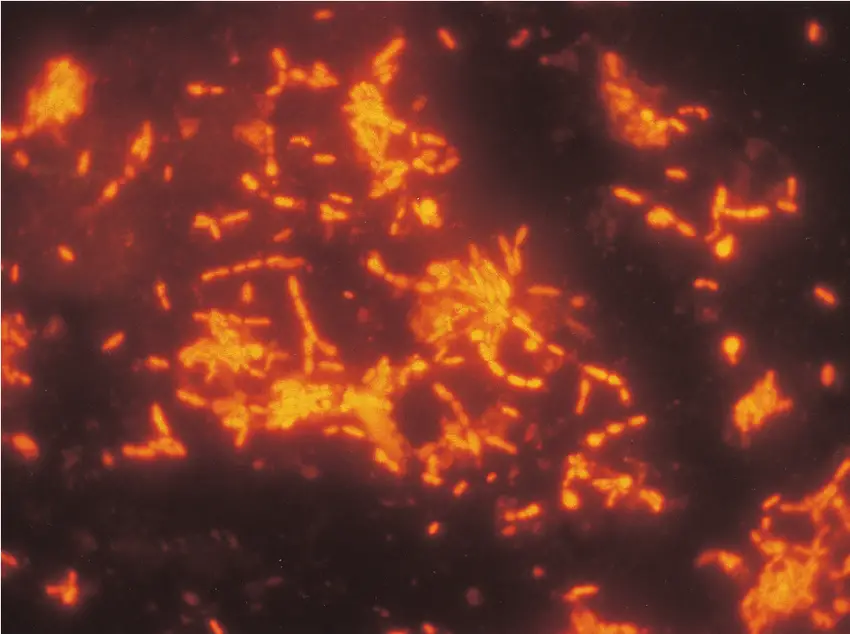 Fluorescent acridine orange stain coryneforms bacteria 