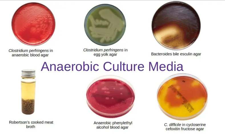 Various types of anaerobic culture media used in diagnostic bacteriology laboratory