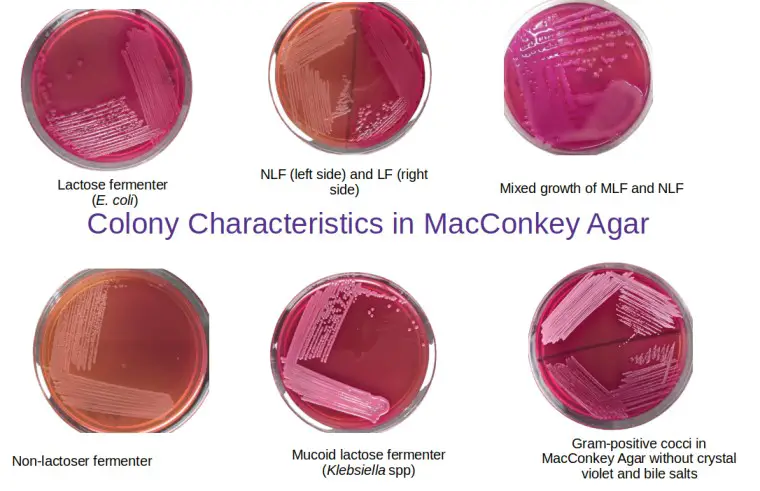 Colony characteristics in MacConkey Agar