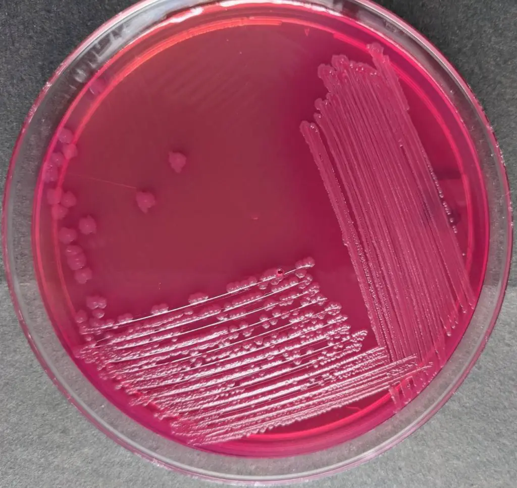 Dry pink colonies of E. coli in MacConkey Agar