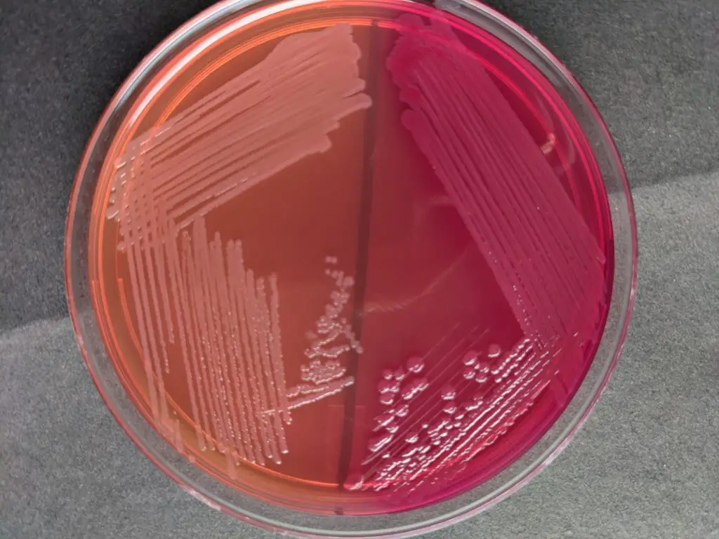 Pale (NLF) and pink (LF) colonies on MacConkey Agar