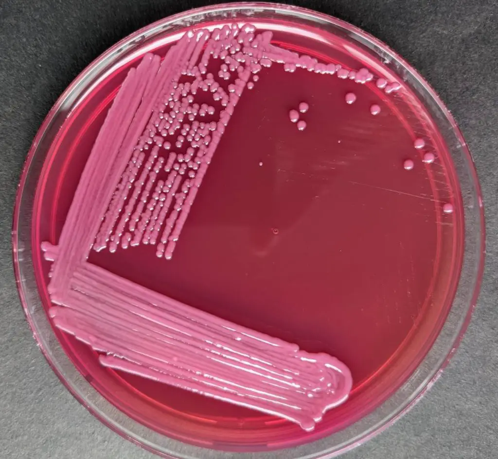 Pink-mucoid colonies of Klebseilla pneumoniae in MacConkey Agar