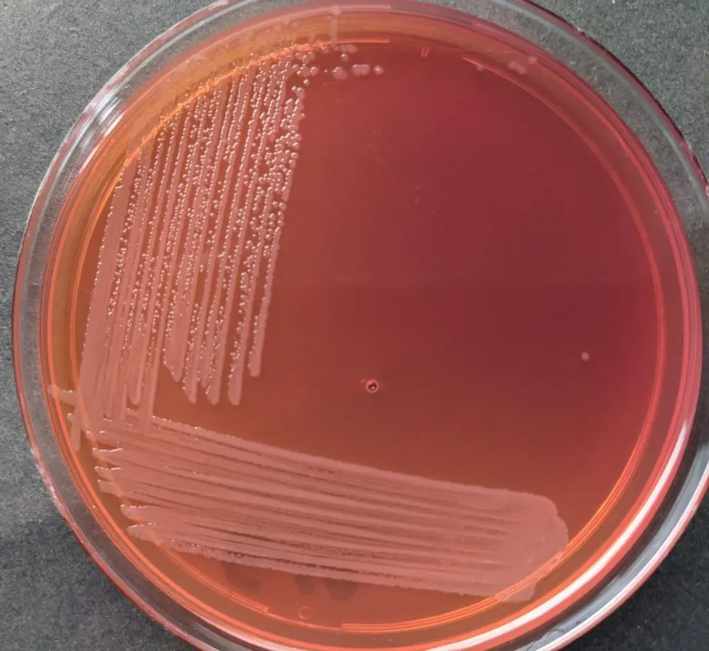 Pale, non-lactose fermenting colonies of Salmonella in MacConkey Agar