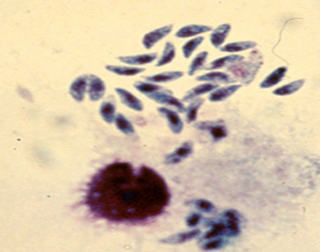 toxoplasma gondii tachyzoites